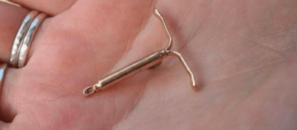 IUD as Birth Control Image