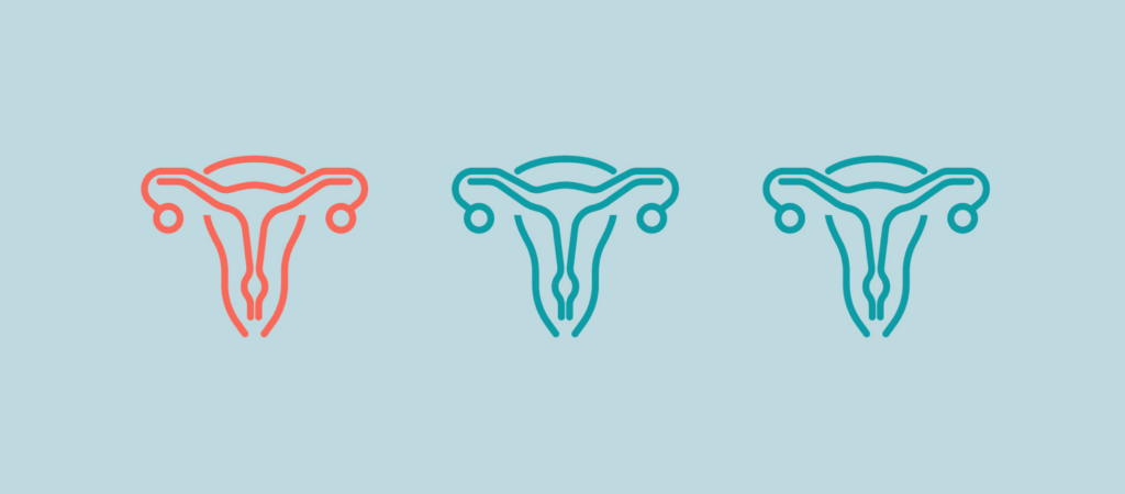 Birth Control and Uterus Didelphys Image