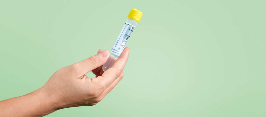 Cuestionario: ¿Cuánto sabe sobre el VPH? Imagen