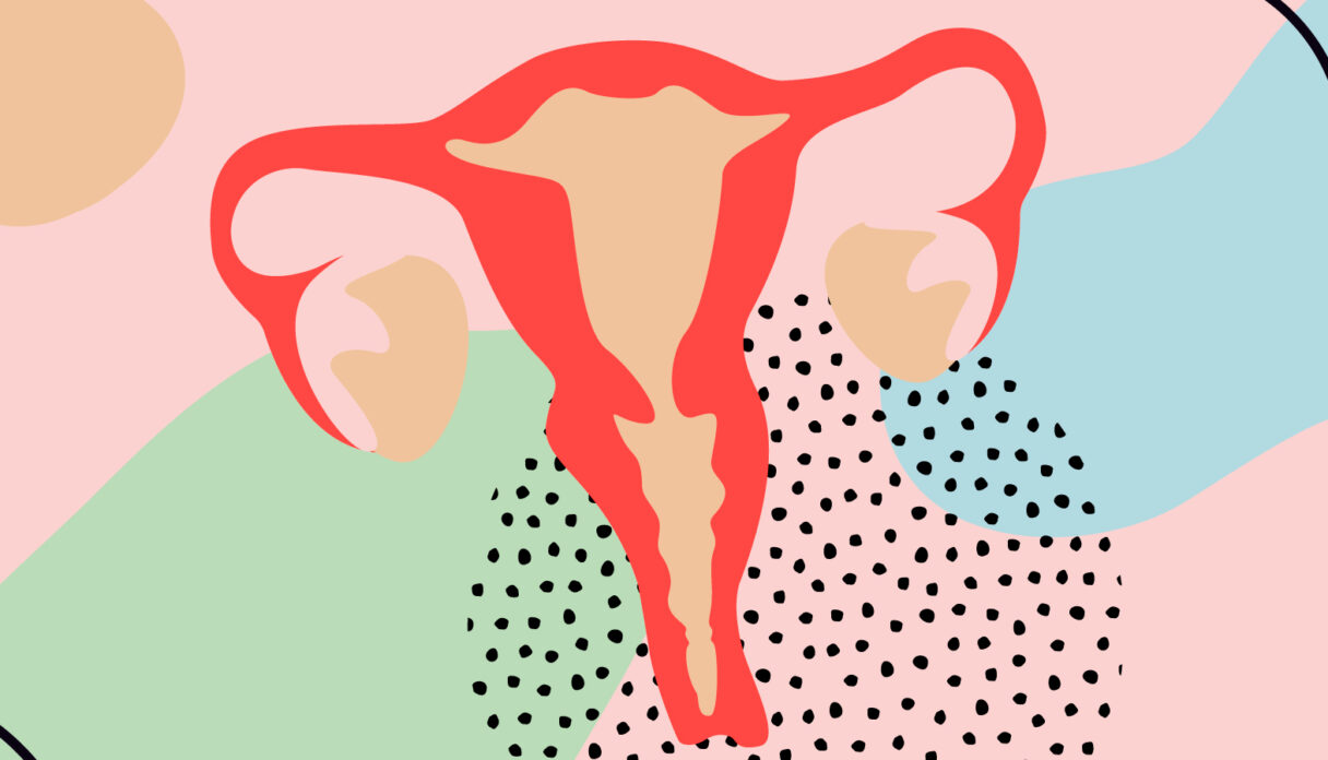 Endometriosis, fertilidad y anticonceptivo