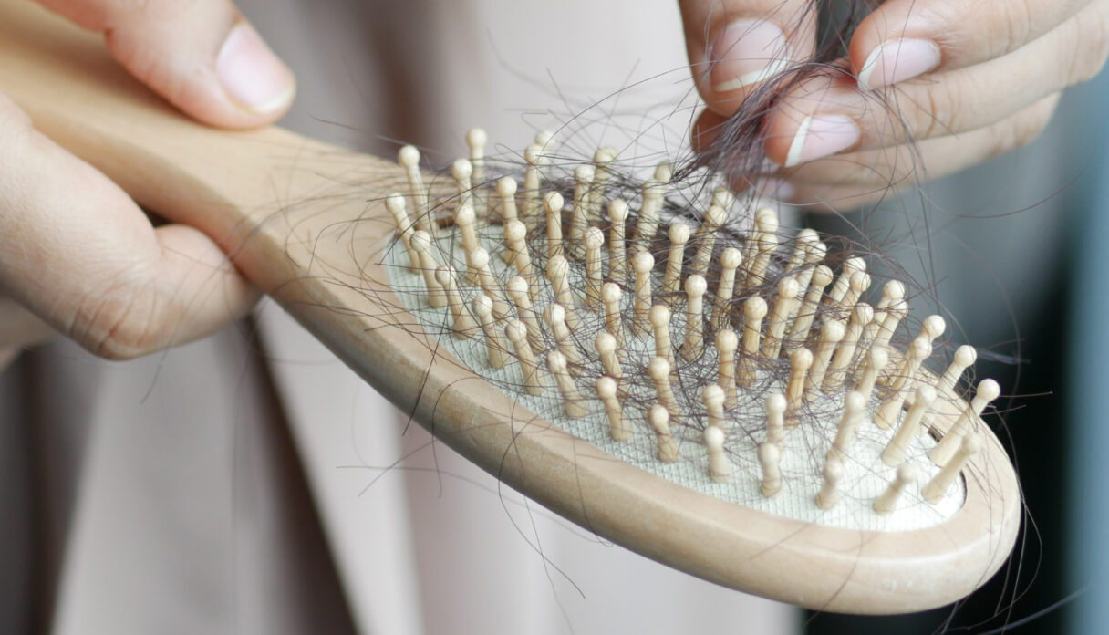 Pérdida de cabello en mujeres: síntomas, causas y opciones de tratamiento